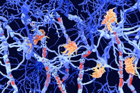 ‘Inverse vaccines’: the promise of a ‘holy grail’ treatment for autoimmune diseases 1 img 2611 1